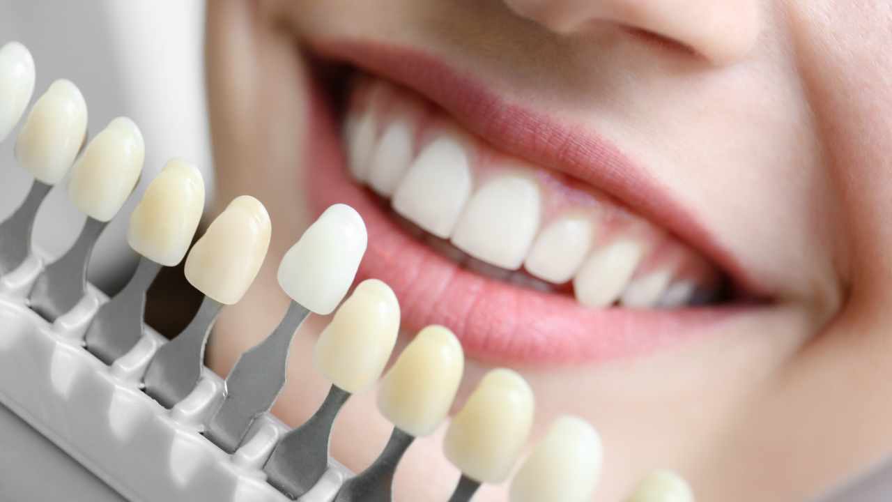 Teeth Whitening: A Brighter Smile Awaits!